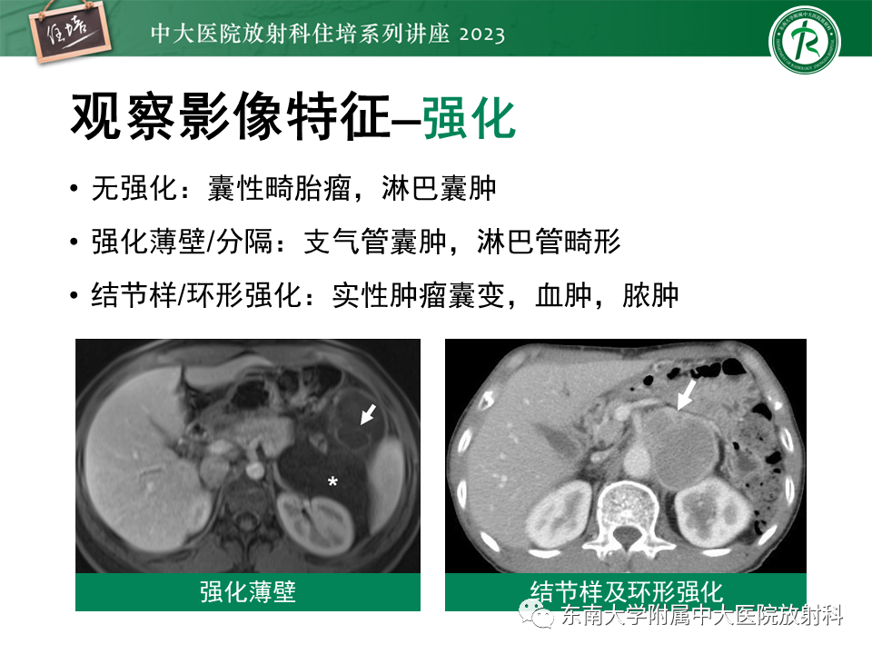 影像PPT - 【PPT】腹膜后原发囊性病变影像诊断思路-20