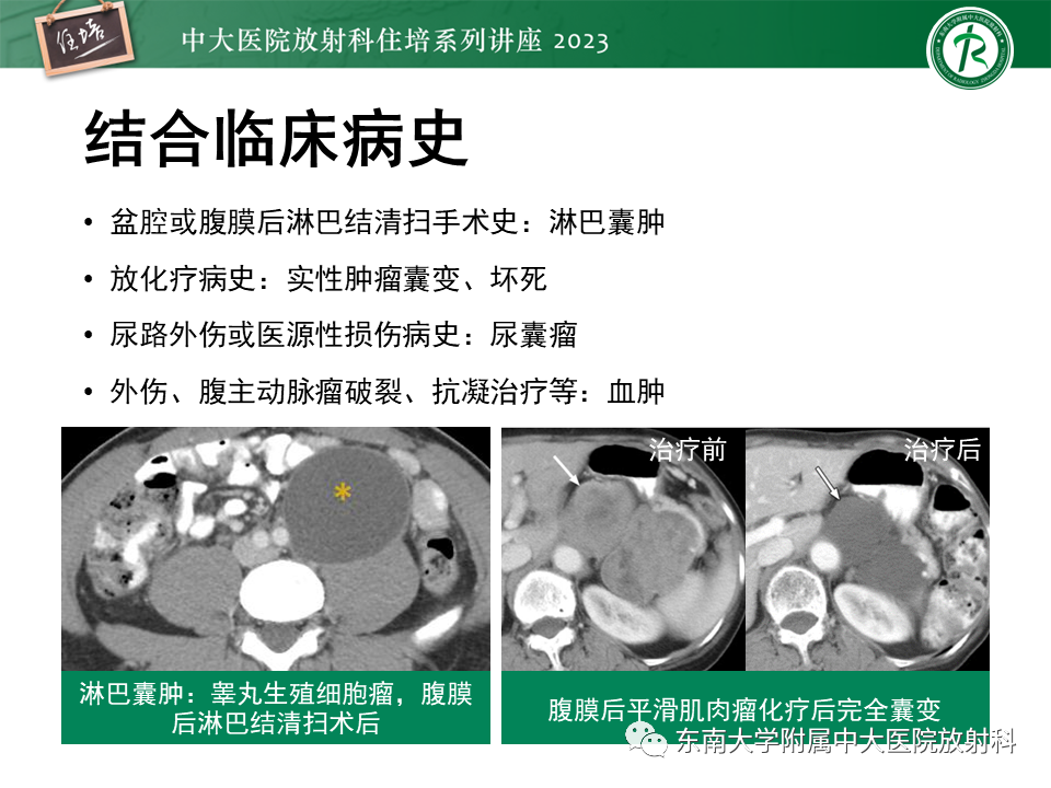 影像PPT - 【PPT】腹膜后原发囊性病变影像诊断思路-21