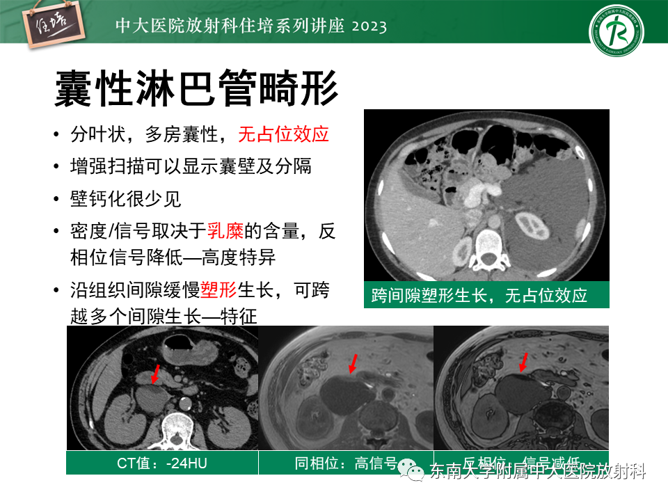 影像PPT - 【PPT】腹膜后原发囊性病变影像诊断思路-24
