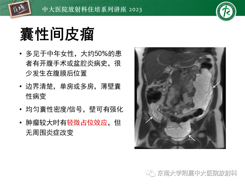 影像PPT - 【PPT】腹膜后原发囊性病变影像诊断思路-26