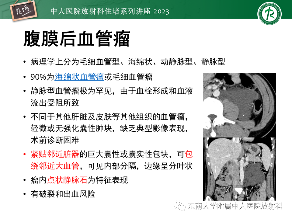 影像PPT - 【PPT】腹膜后原发囊性病变影像诊断思路-28