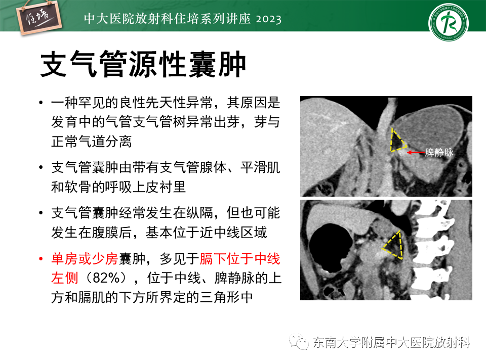 影像PPT - 【PPT】腹膜后原发囊性病变影像诊断思路-29