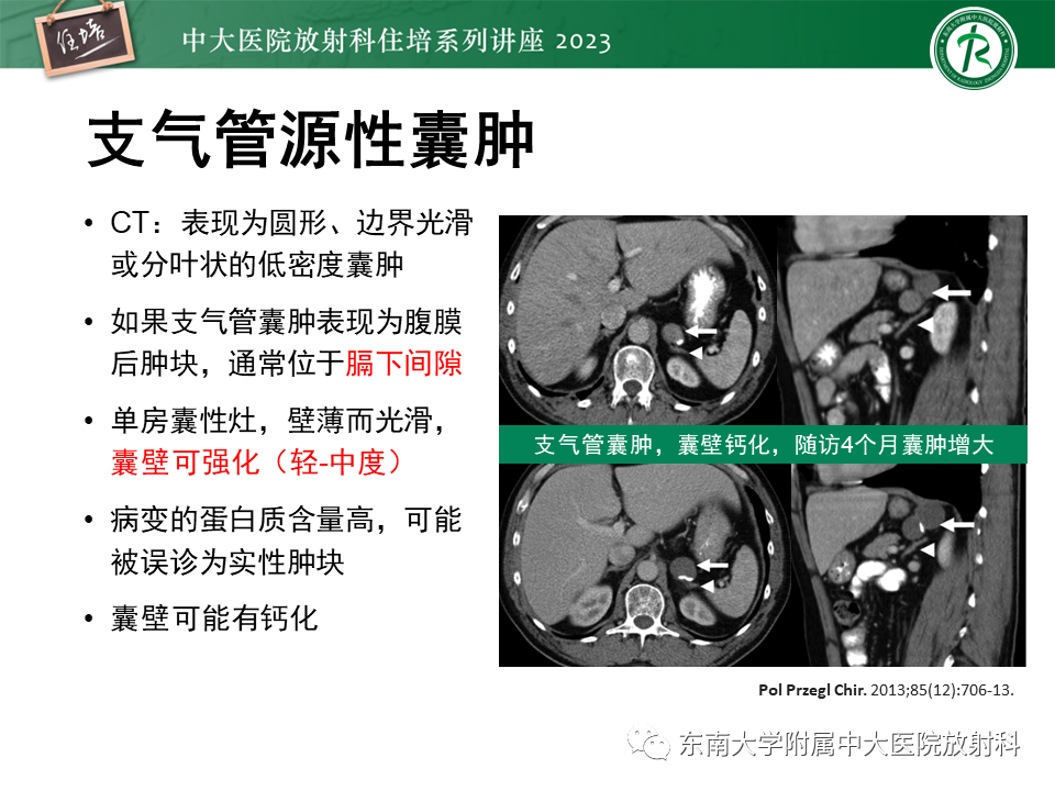 影像PPT - 【PPT】腹膜后原发囊性病变影像诊断思路-30