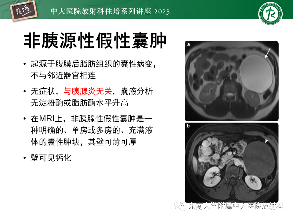 影像PPT - 【PPT】腹膜后原发囊性病变影像诊断思路-36