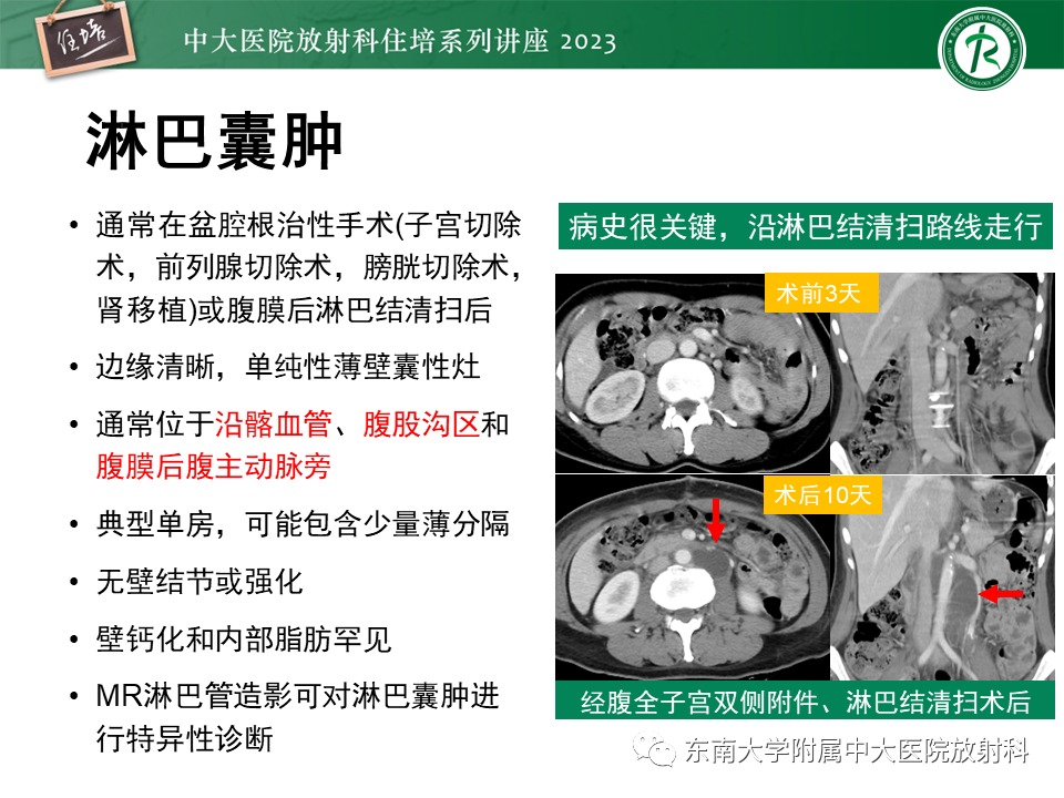 影像PPT - 【PPT】腹膜后原发囊性病变影像诊断思路-37