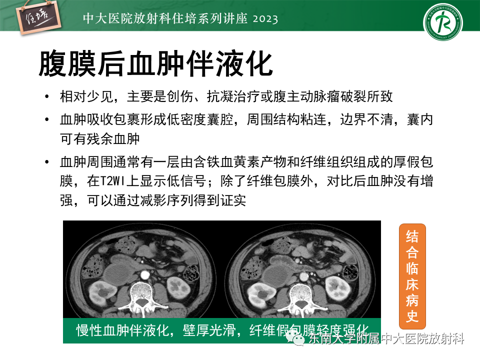影像PPT - 【PPT】腹膜后原发囊性病变影像诊断思路-39