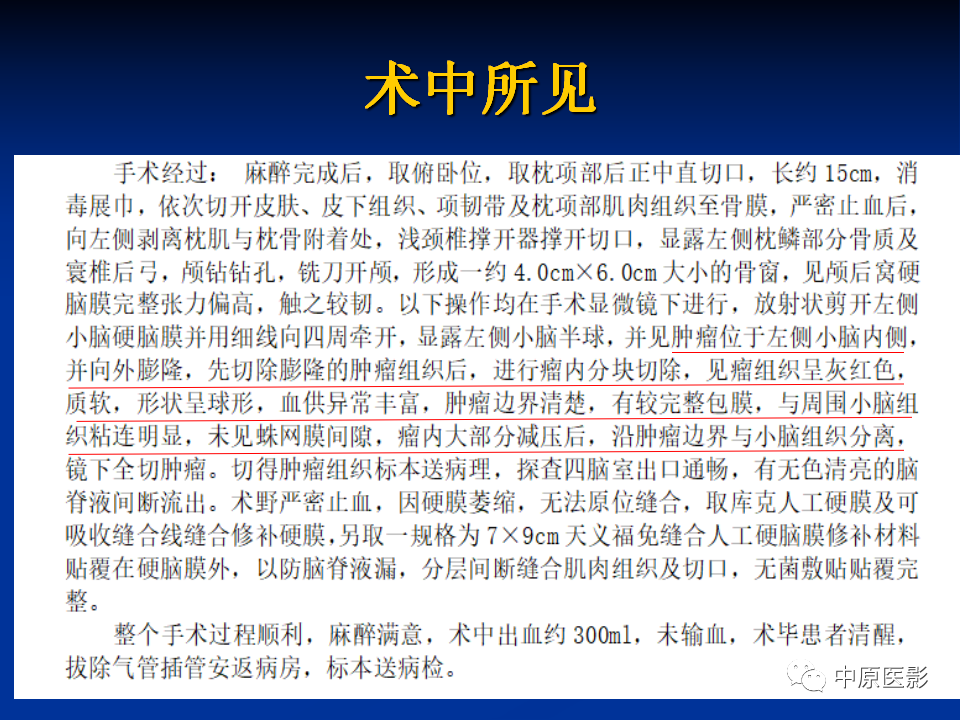 影像PPT - 【病例】小脑脂肪神经细胞瘤1例MR影像-11