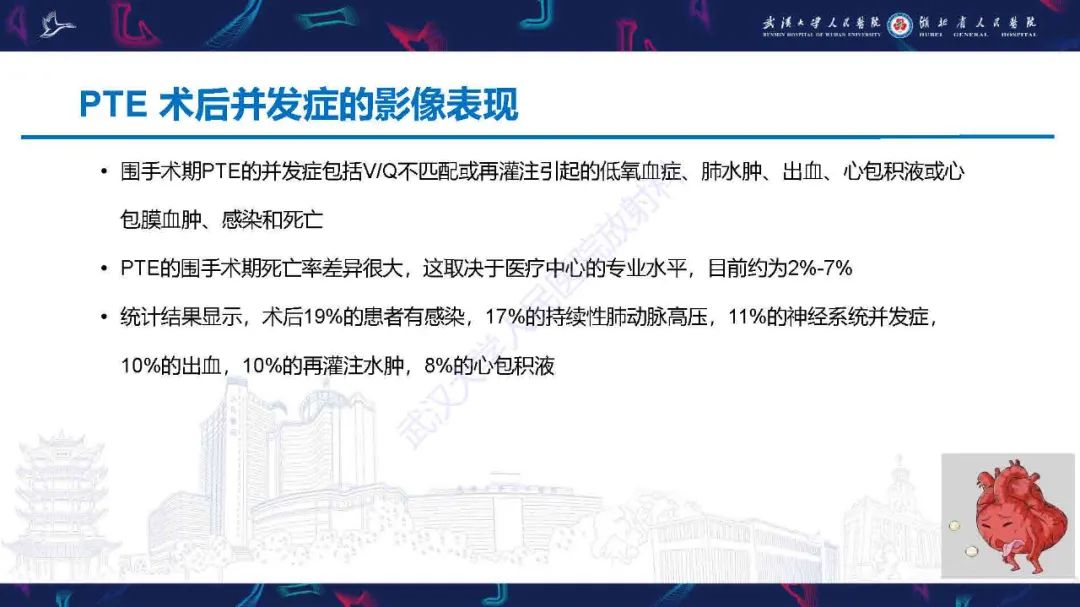 影像PPT - 【PPT】慢性血栓栓塞性肺动脉高压影像诊断-30