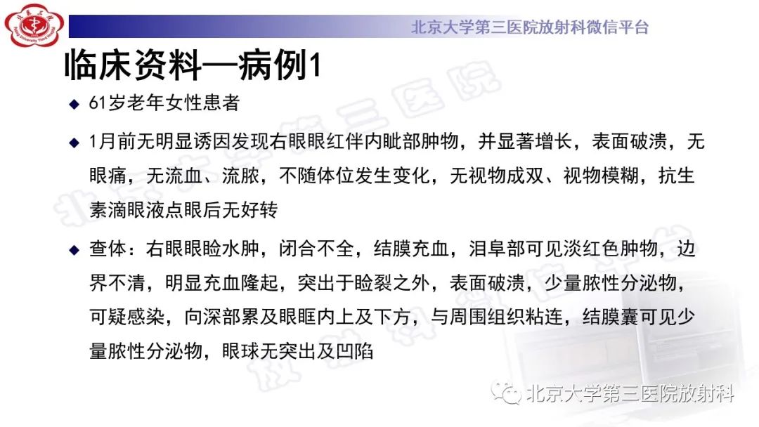 影像PPT - 【PPT】眼附属器淋巴瘤-2