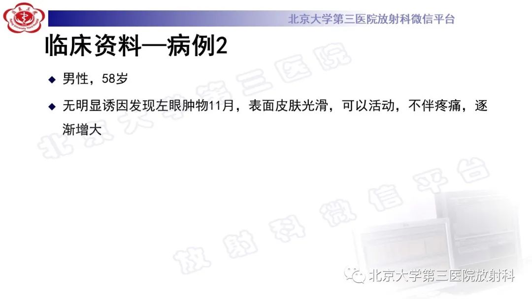 影像PPT - 【PPT】眼附属器淋巴瘤-8