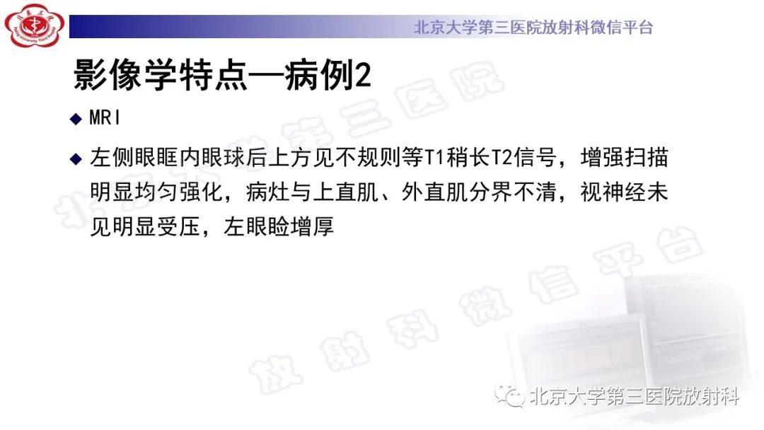 影像PPT - 【PPT】眼附属器淋巴瘤-10
