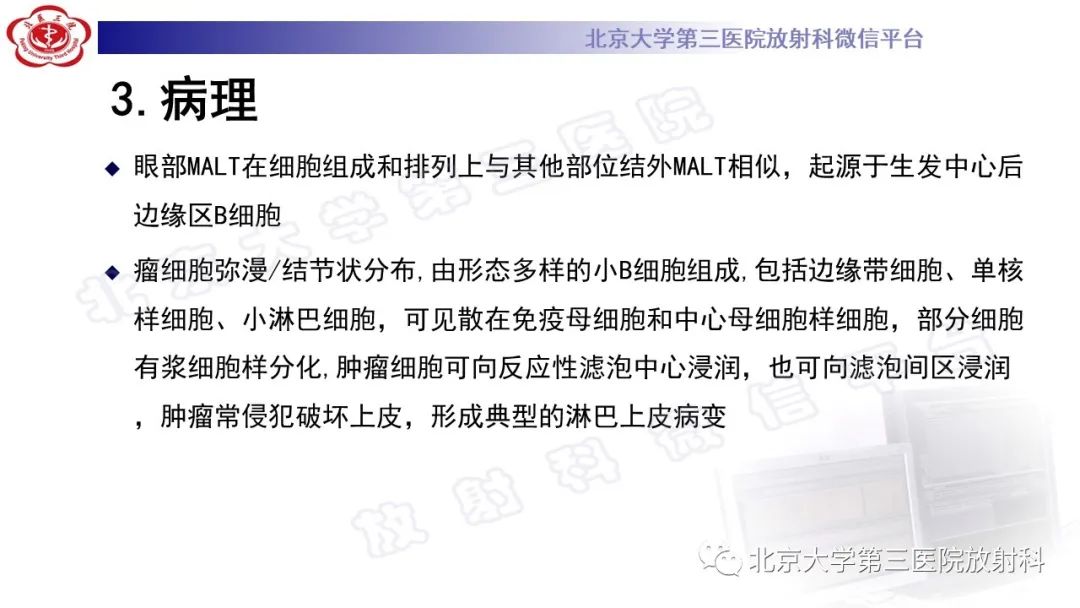 影像PPT - 【PPT】眼附属器淋巴瘤-16