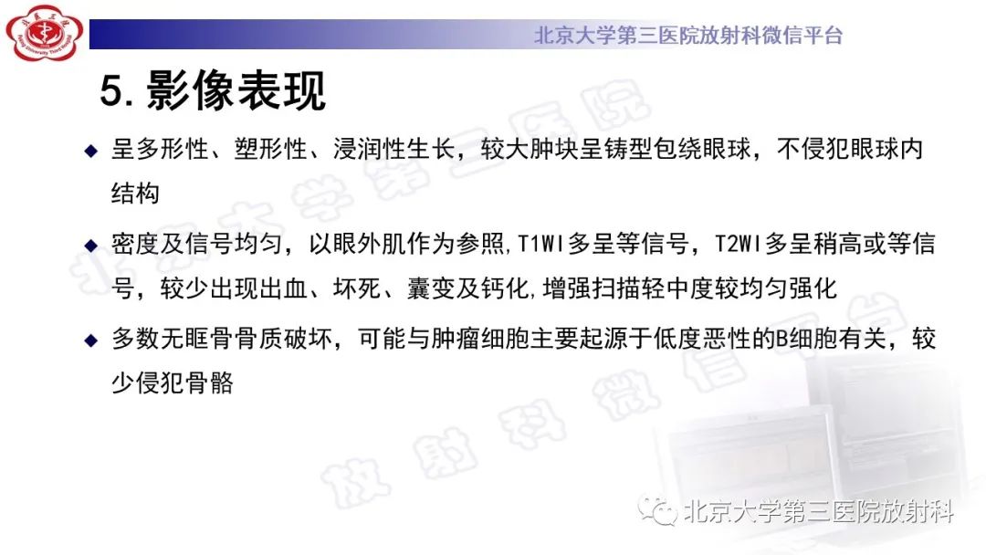 影像PPT - 【PPT】眼附属器淋巴瘤-19