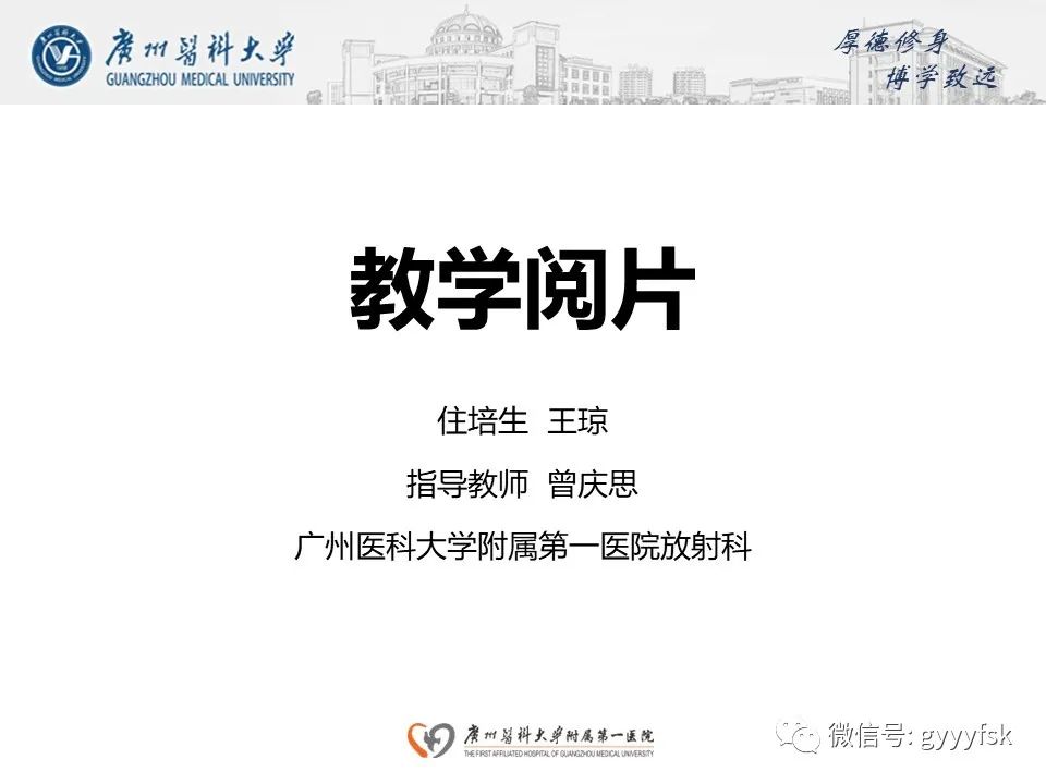 影像PPT - 【病例】肺动脉肉瘤1例CT影像-1