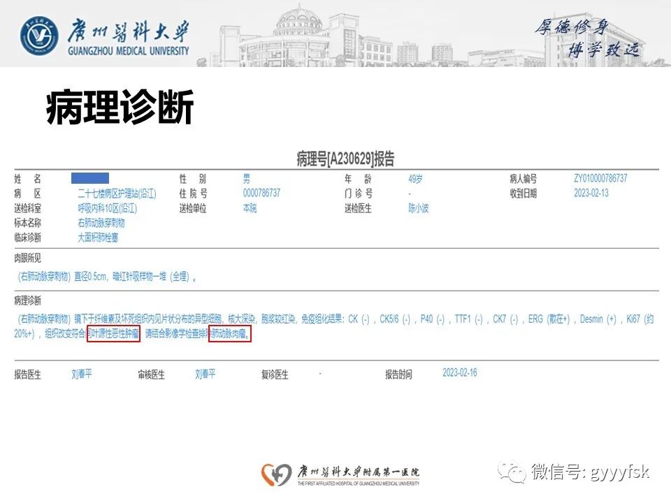 影像PPT - 【病例】肺动脉肉瘤1例CT影像-14