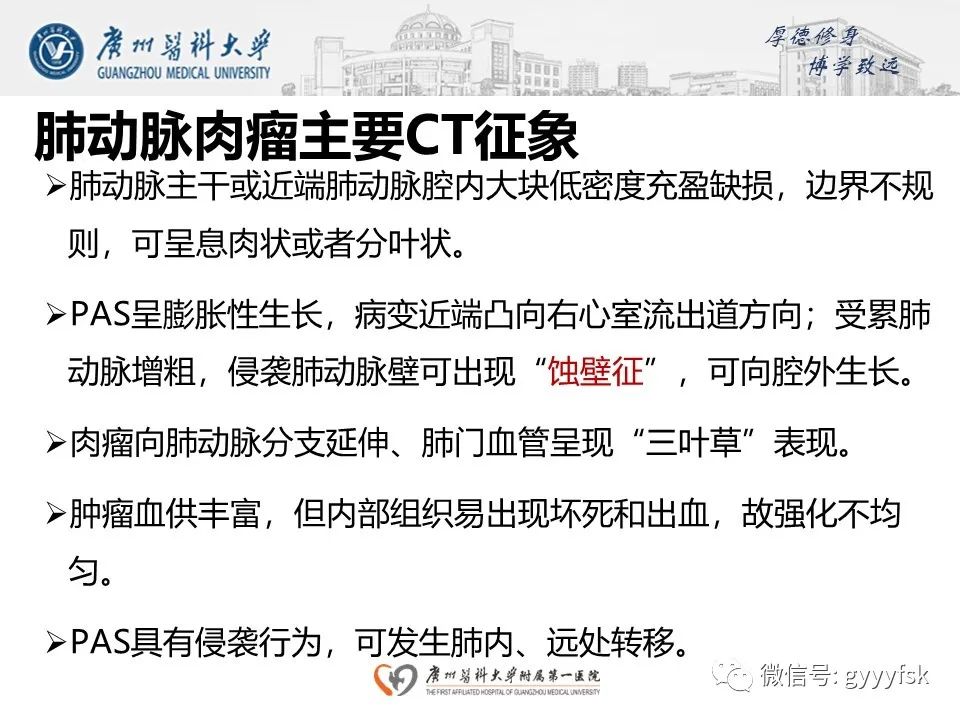 影像PPT - 【病例】肺动脉肉瘤1例CT影像-20