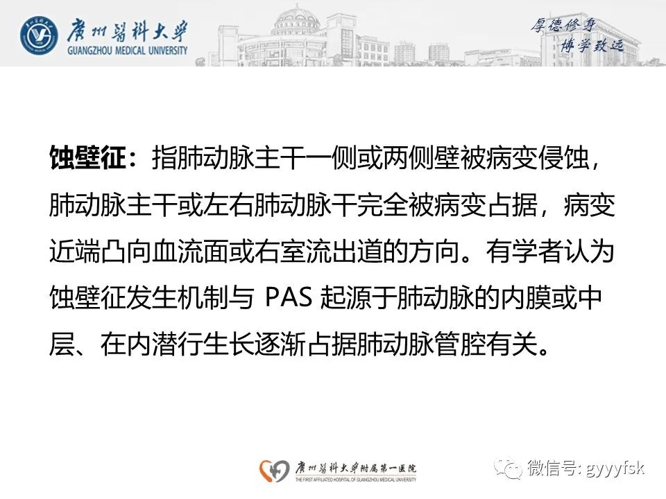 影像PPT - 【病例】肺动脉肉瘤1例CT影像-21
