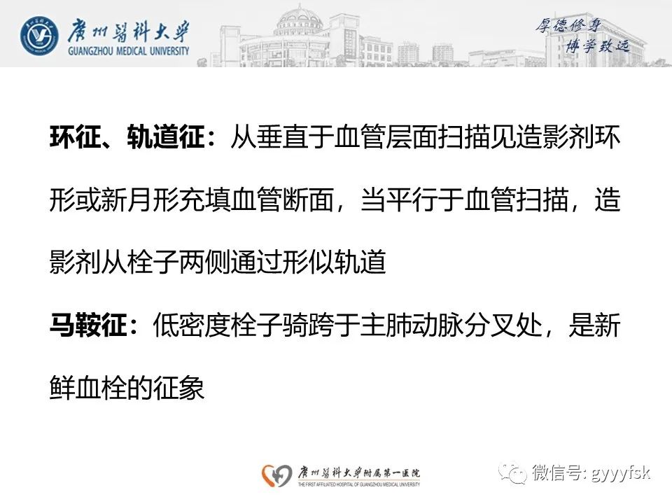 影像PPT - 【病例】肺动脉肉瘤1例CT影像-31
