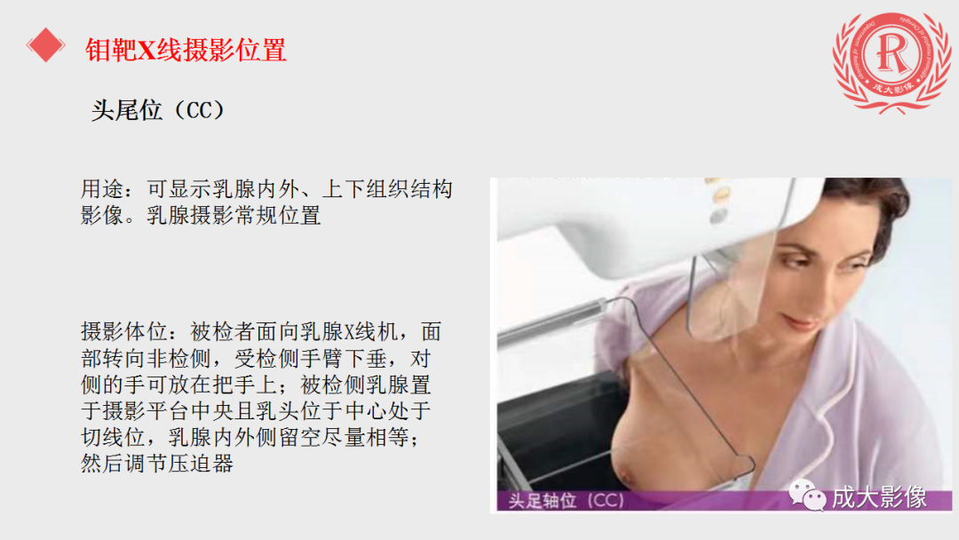 影像PPT - 【PPT】乳腺影像学检查-7