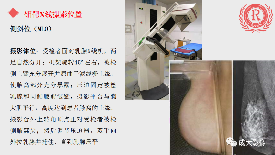 影像PPT - 【PPT】乳腺影像学检查-11