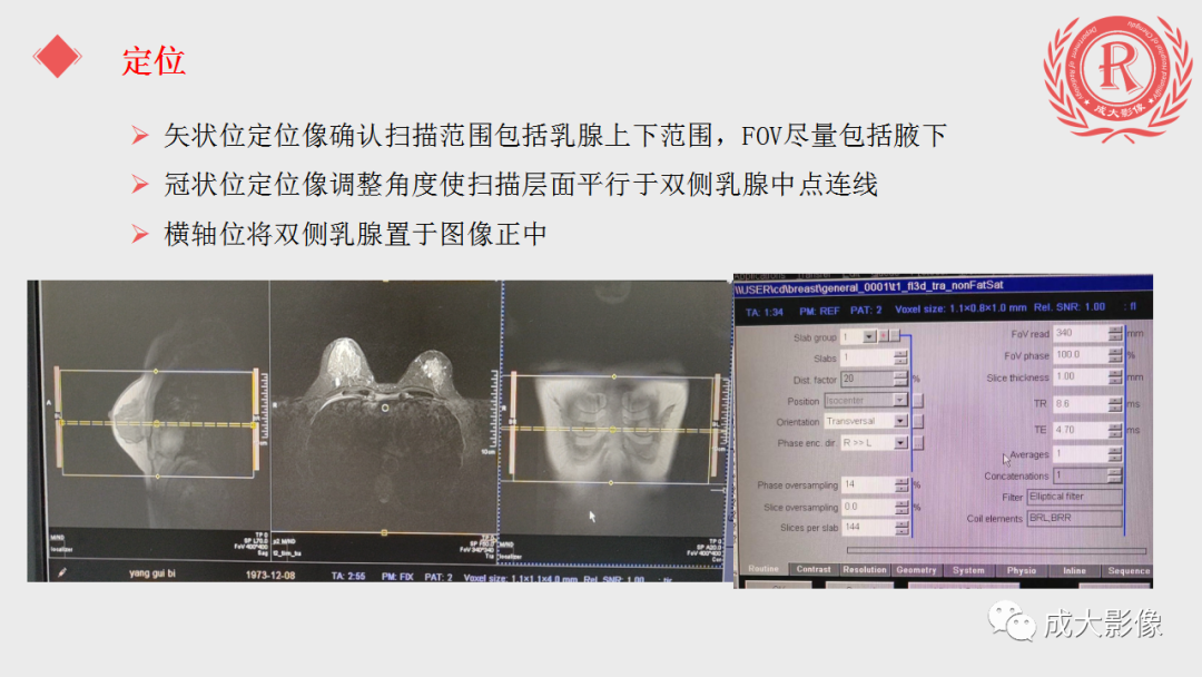 影像PPT - 【PPT】乳腺影像学检查-31