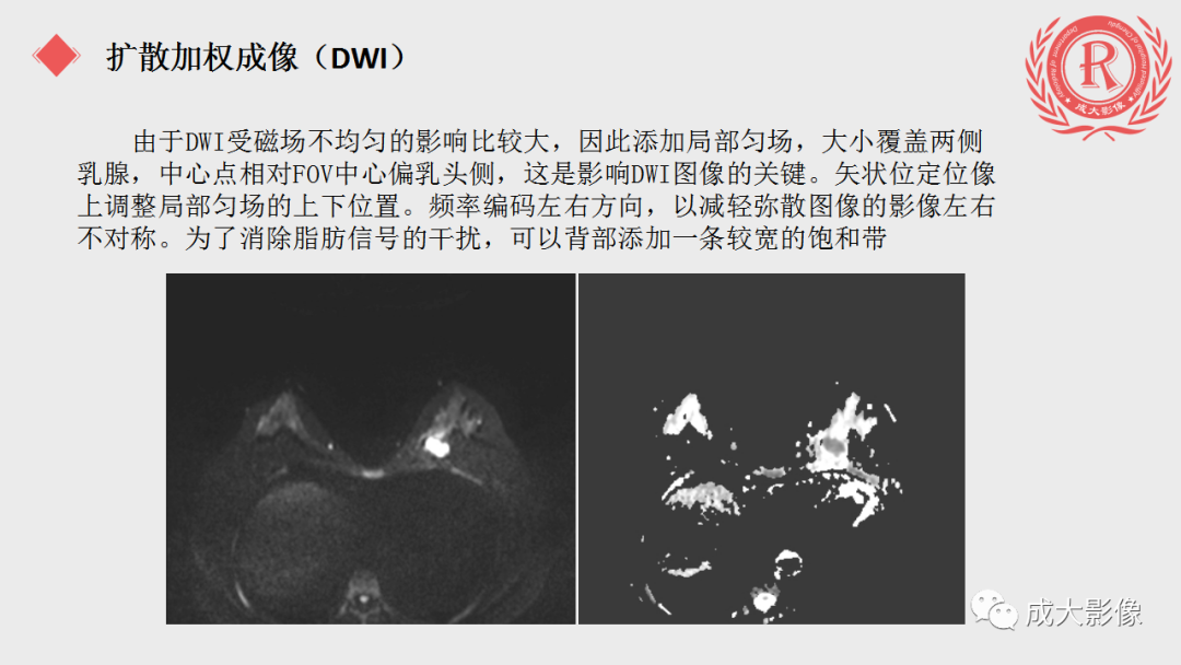 影像PPT - 【PPT】乳腺影像学检查-34