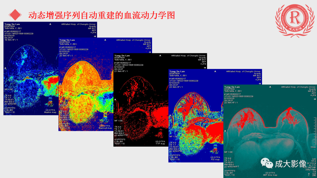 影像PPT - 【PPT】乳腺影像学检查-38
