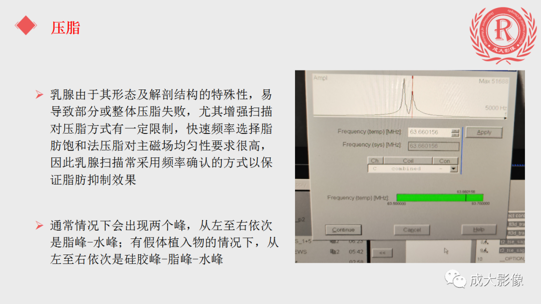 影像PPT - 【PPT】乳腺影像学检查-42