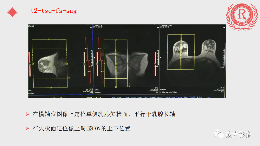 影像PPT - 【PPT】乳腺影像学检查-43