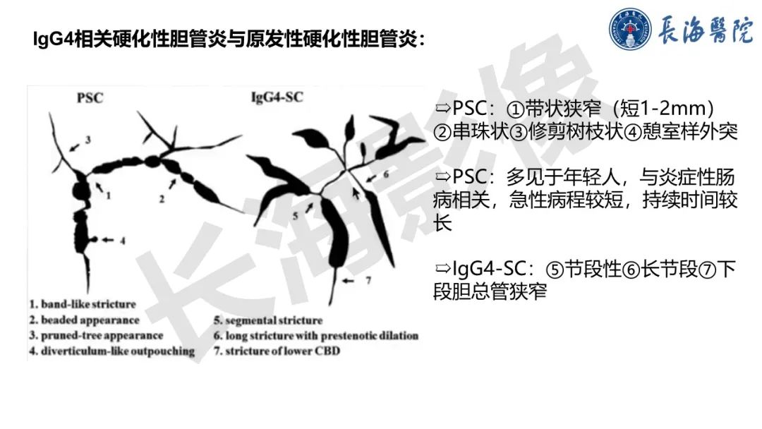 影像PPT - 【PPT】IgG4相关性疾病-15
