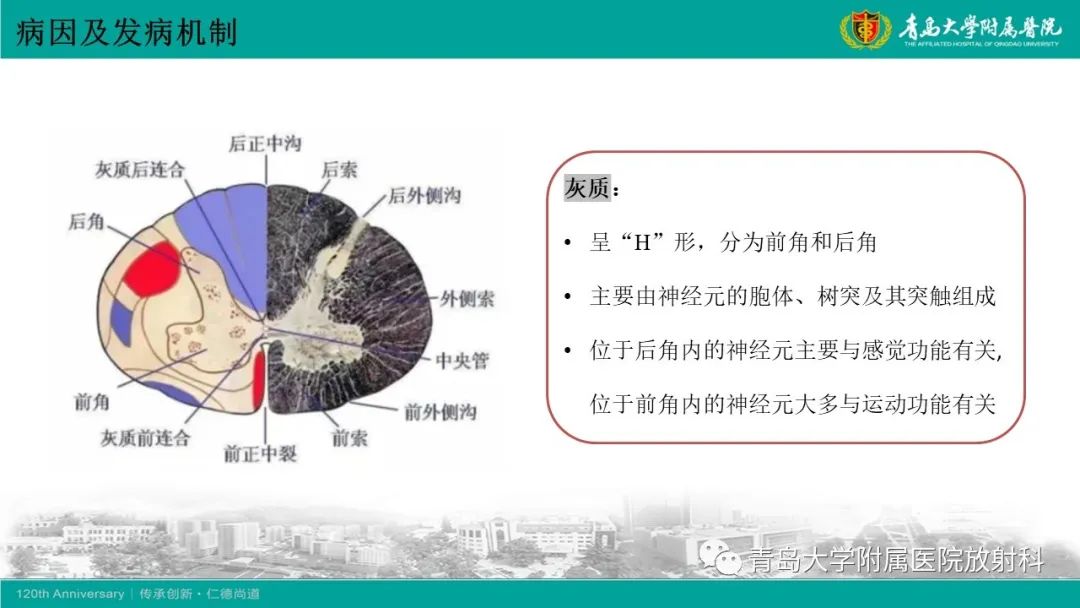 影像PPT - 【病例】脊髓亚急性联合变性1例MR影像-8
