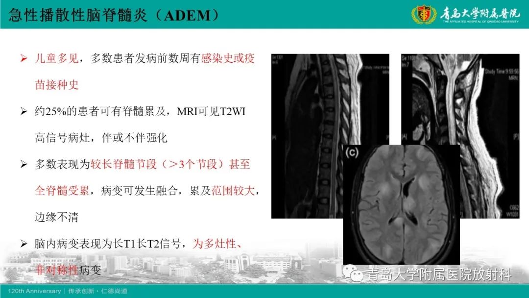 影像PPT - 【病例】脊髓亚急性联合变性1例MR影像-18