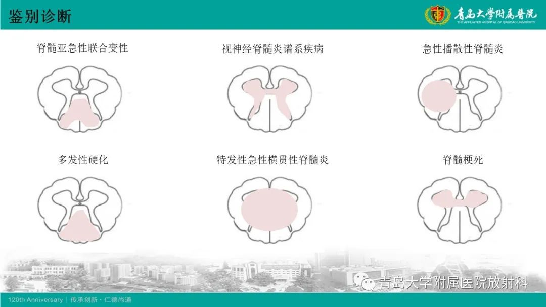 影像PPT - 【病例】脊髓亚急性联合变性1例MR影像-23