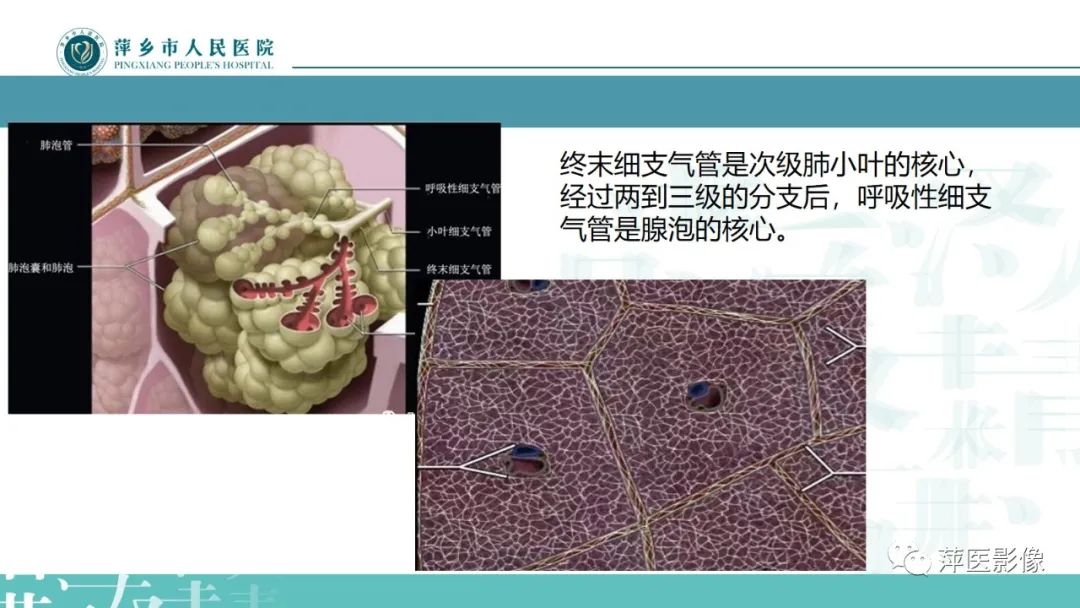 影像PPT - 【PPT】病毒性肺炎解剖、病理和影像诊断-6