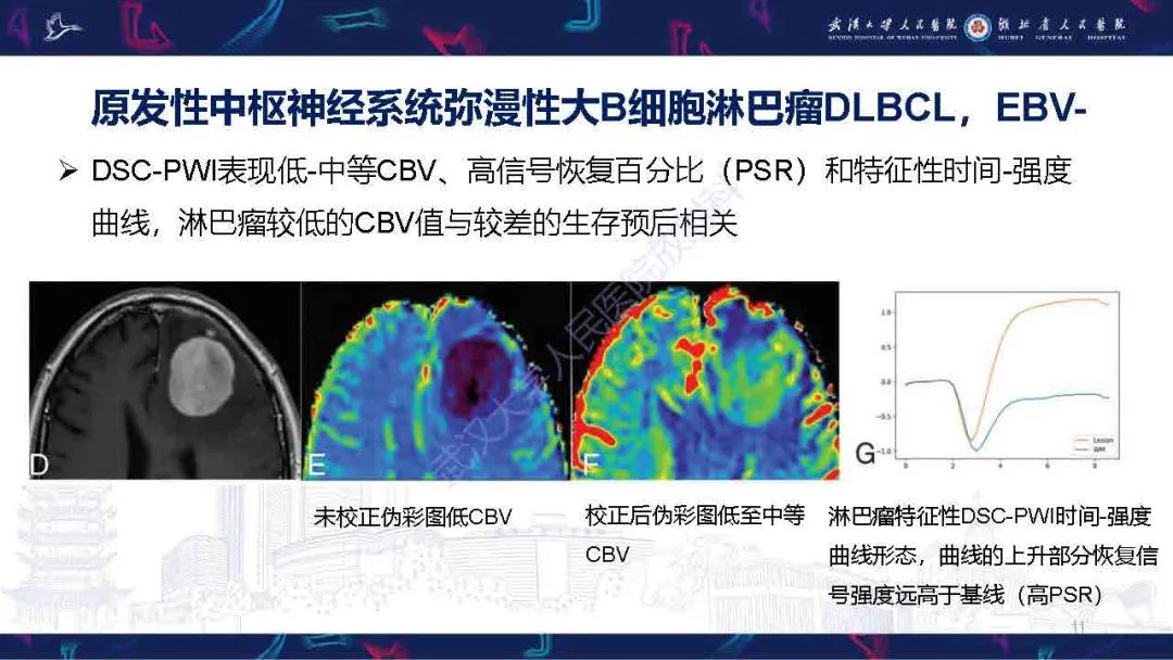 影像PPT - 【PPT】中枢神经系统淋巴瘤WHO分类更新及影像诊断-11