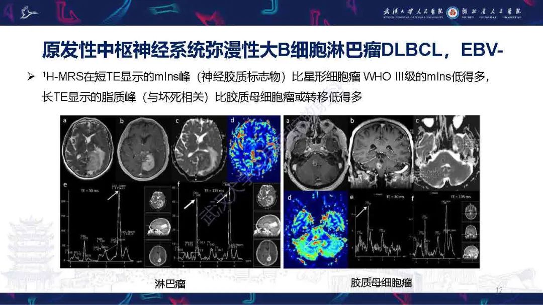 影像PPT - 【PPT】中枢神经系统淋巴瘤WHO分类更新及影像诊断-12