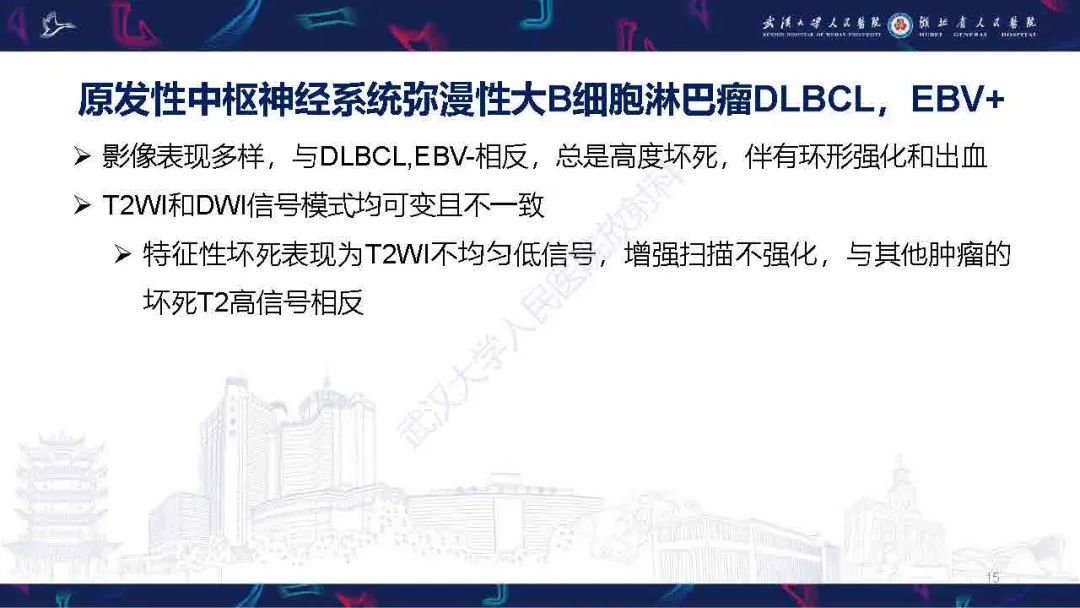 影像PPT - 【PPT】中枢神经系统淋巴瘤WHO分类更新及影像诊断-15