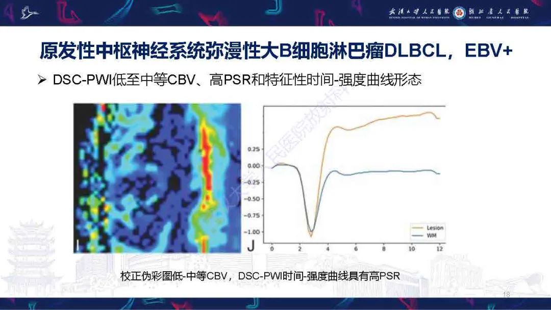 影像PPT - 【PPT】中枢神经系统淋巴瘤WHO分类更新及影像诊断-18