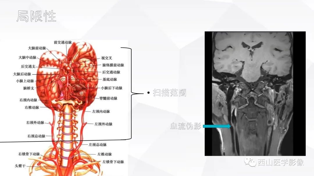 影像PPT - 【PPT】头颈部动脉磁共振高分辨血管壁成像报告书写规范及病例分析-1