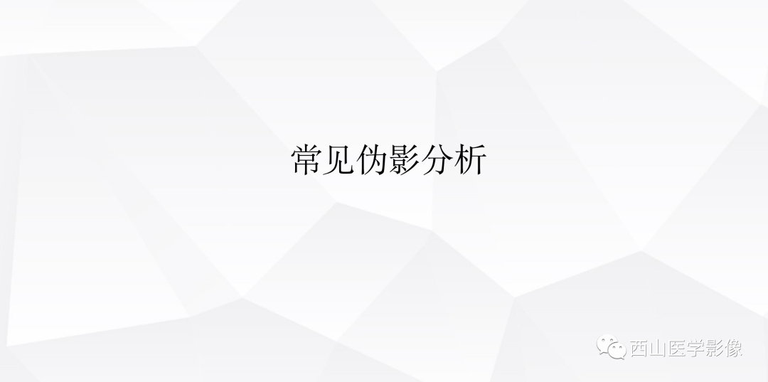 影像PPT - 【PPT】头颈部动脉磁共振高分辨血管壁成像报告书写规范及病例分析-4