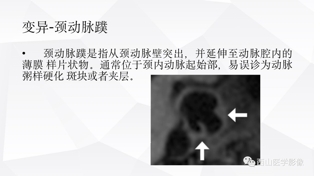 影像PPT - 【PPT】头颈部动脉磁共振高分辨血管壁成像报告书写规范及病例分析-10
