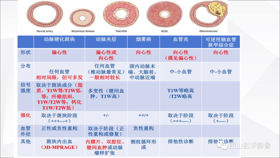 影像PPT - 【PPT】头颈部动脉磁共振高分辨血管壁成像报告书写规范及病例分析-59