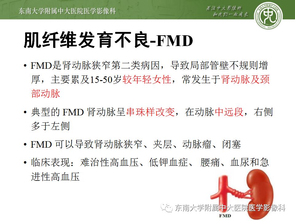 影像PPT - 【PPT】肾动脉常见病变-14
