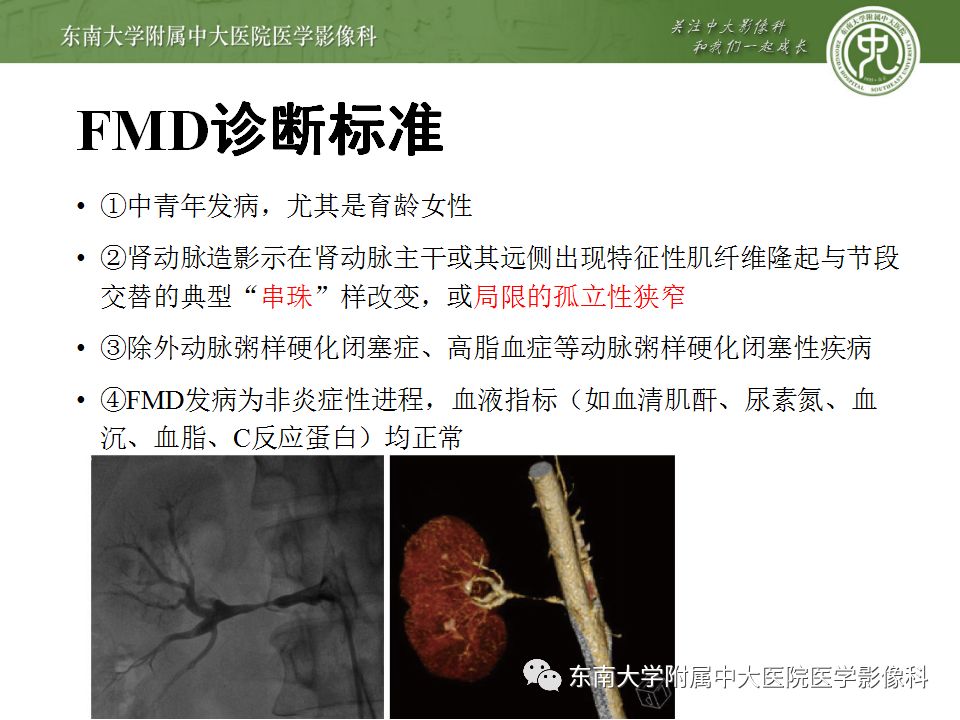 影像PPT - 【PPT】肾动脉常见病变-16