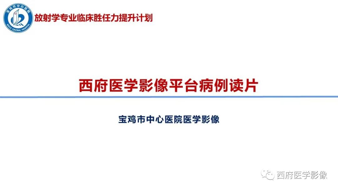 影像PPT - 【病例】脑室系统脑膜瘤1例CT及MR影像表现与鉴别-1