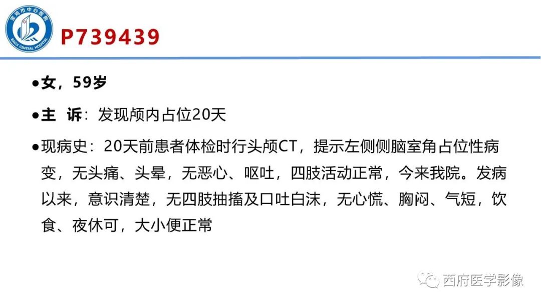 影像PPT - 【病例】脑室系统脑膜瘤1例CT及MR影像表现与鉴别-2