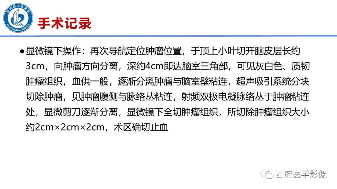 影像PPT - 【病例】脑室系统脑膜瘤1例CT及MR影像表现与鉴别-12