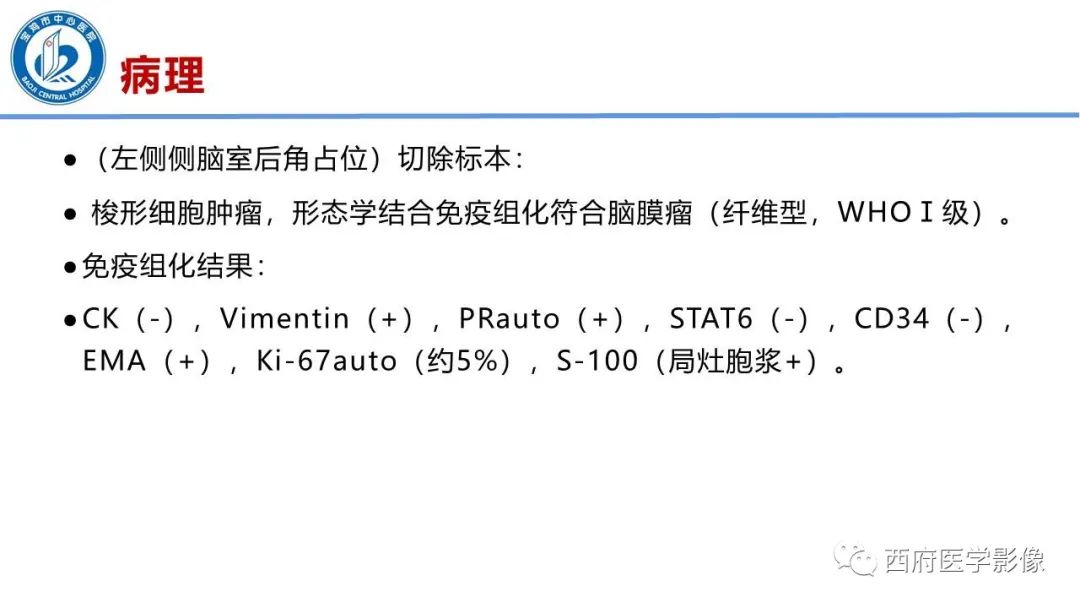 影像PPT - 【病例】脑室系统脑膜瘤1例CT及MR影像表现与鉴别-13