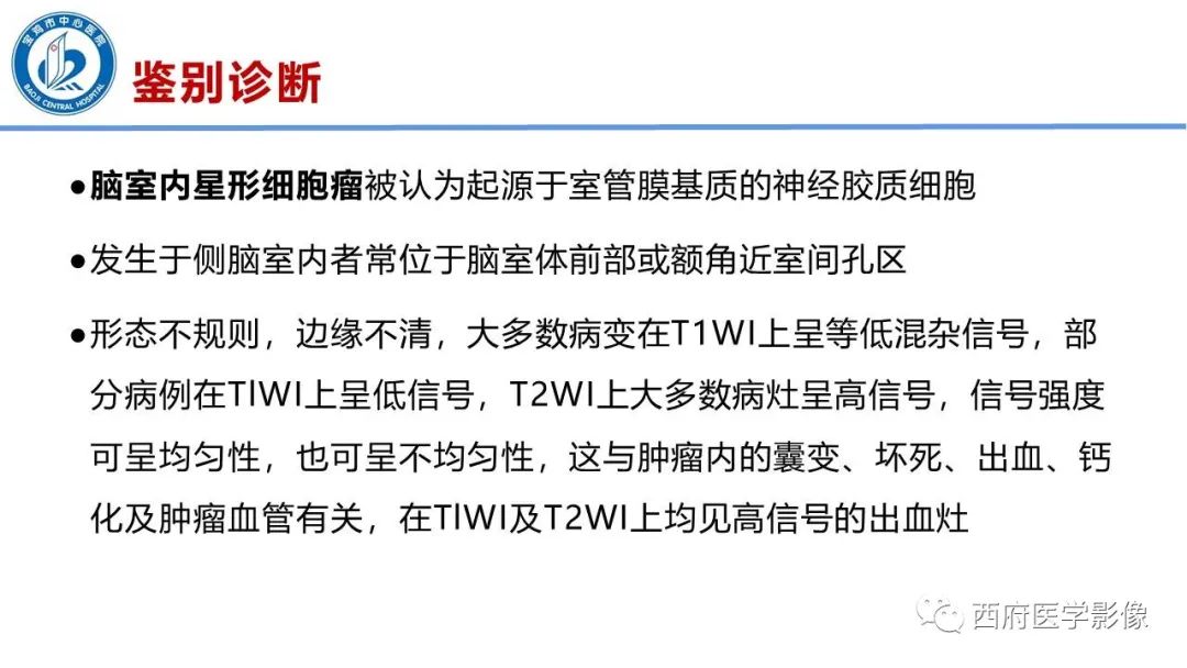 影像PPT - 【病例】脑室系统脑膜瘤1例CT及MR影像表现与鉴别-16