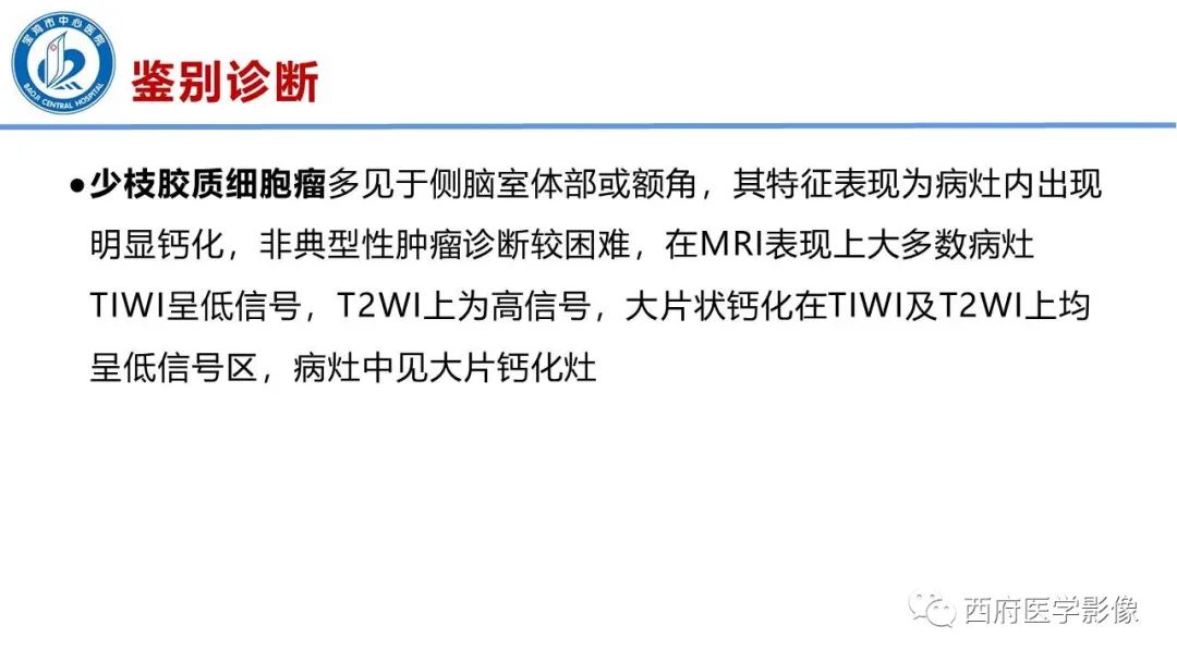 影像PPT - 【病例】脑室系统脑膜瘤1例CT及MR影像表现与鉴别-21